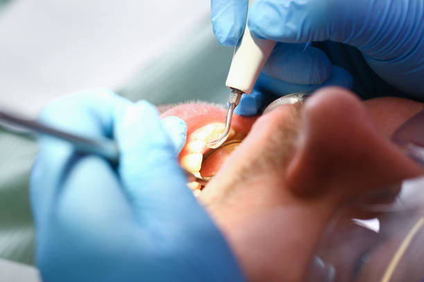 Best Emergency Treatment for Jaw Pain or Injury in Spring Arbor, MI
