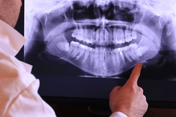 Best Emergency Dental Care for Sports Injuries in Spring Arbor, MI