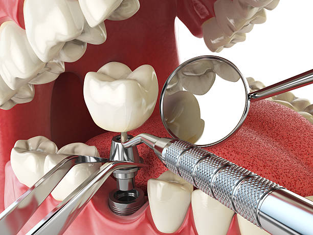 Best Emergency Pediatric Dental Care in Spring Arbor, MI